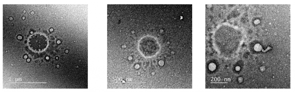 Transmission microscopy images of areas of inhibition. The images show structures that resemble certain viruses. Results need to be confirmed.