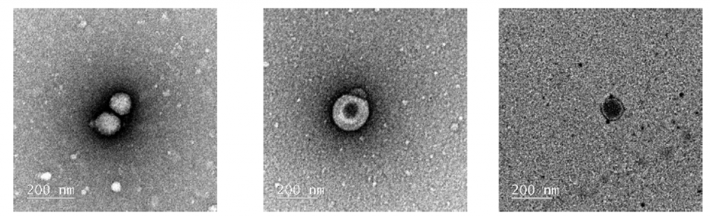 Transmission microscopy images of areas of inhibition. The images show structures that resemble certain viruses. Results need to be confirmed.