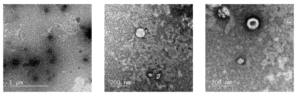 Transmission microscopy images of areas of inhibition. The images show structures that resemble certain viruses. Results need to be confirmed.